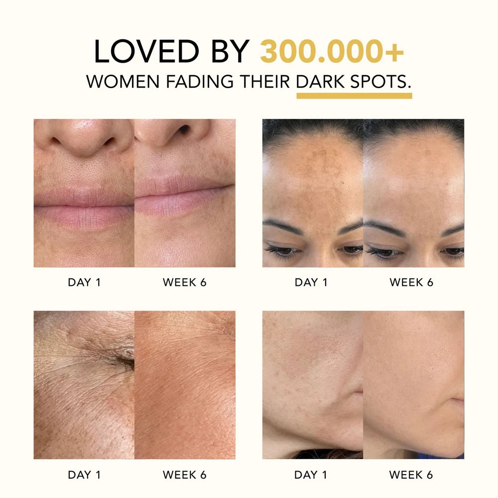 Turmeric and Kojic Acid Overnight Mask