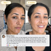 Turmeric and Kojic Acid Overnight Mask