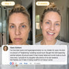 Turmeric and Kojic Acid Overnight Mask